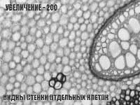 Корневище папоротника орляка с разным увеличением